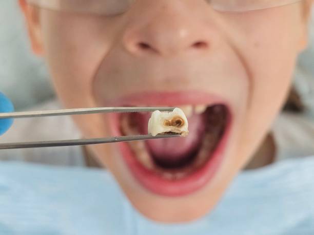 Best Emergency Dental Care for Trauma or Injury in Maury, NC