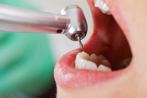 Best Emergency Dental Surgery in Maury, NC